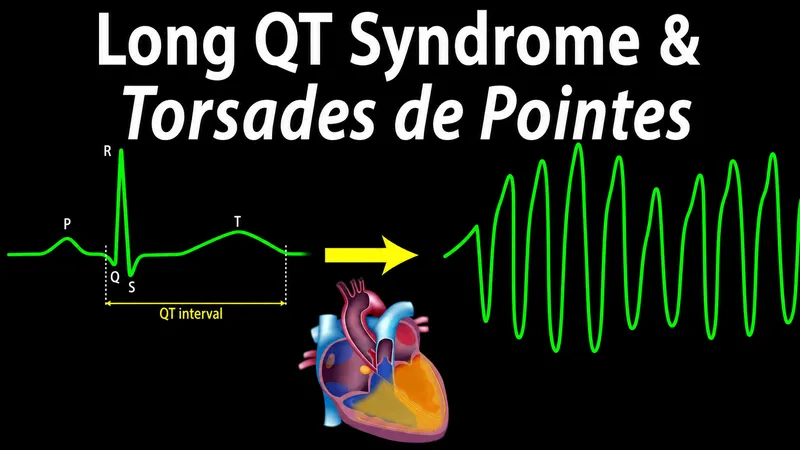 ECG: QT prolongation to Torsades de Pointes