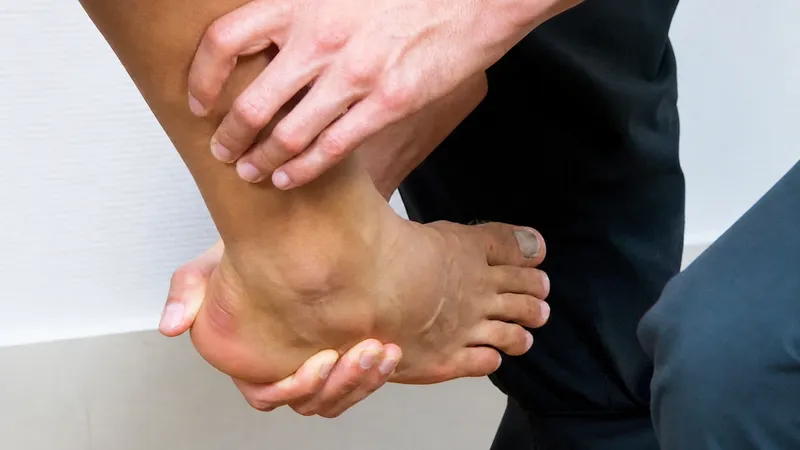 Talar Tilt Test for Ankle Sprain