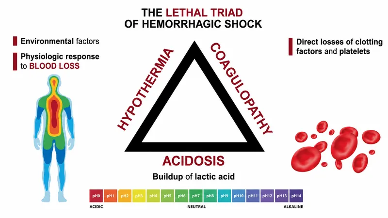 Lethal Triad of Hemorrhagic Shock Diagram