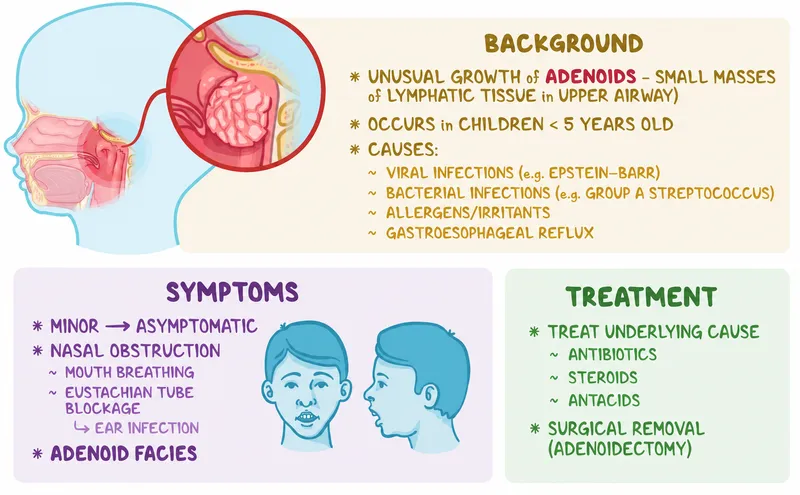 Adenoid Hypertrophy: Background, Symptoms, Treatment