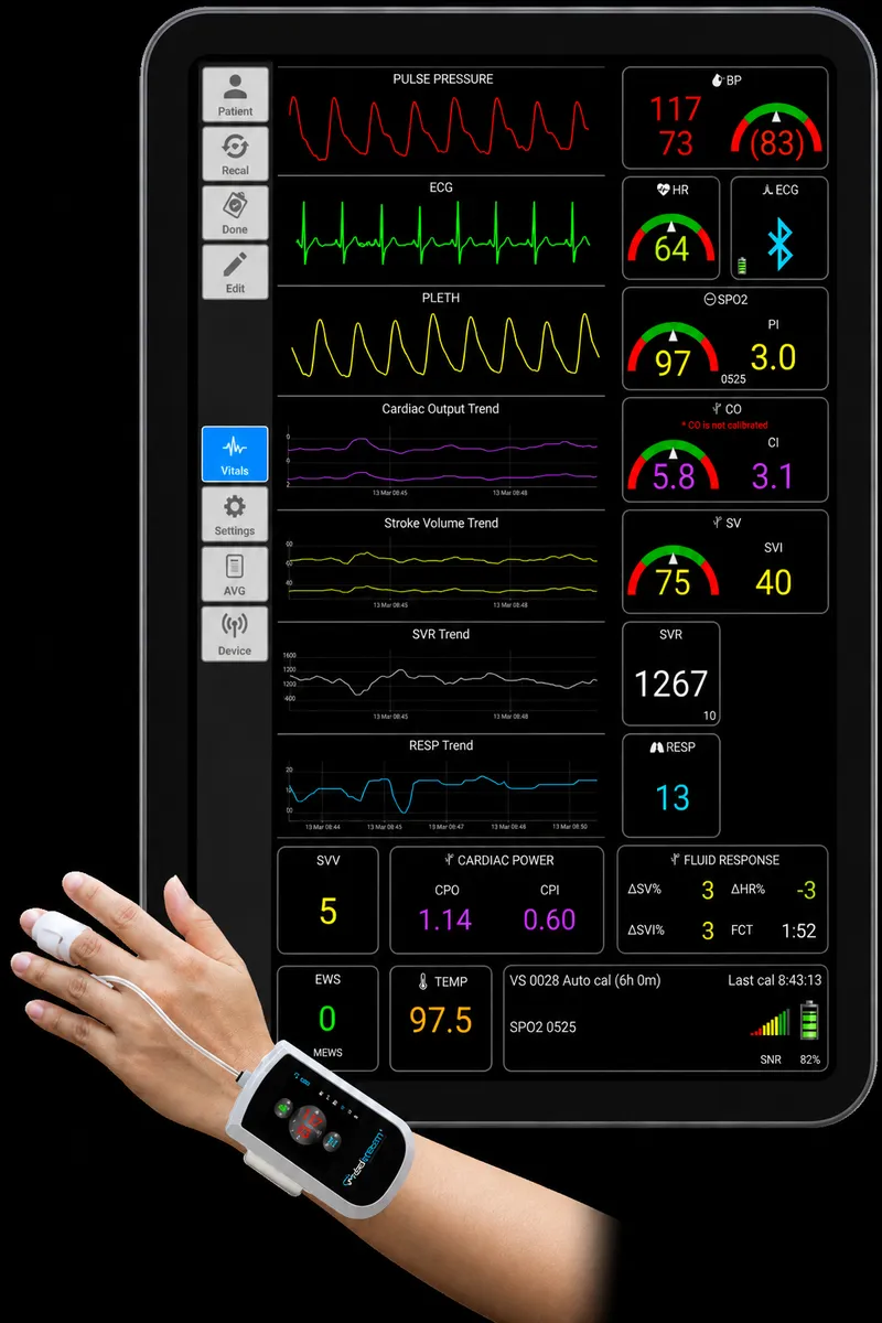 Post-operative monitoring setup with multiple vital sign displays