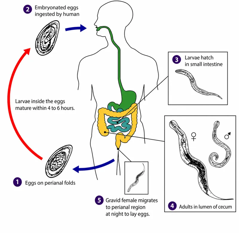 Enterobius vermicularis (pinworm) life cycle