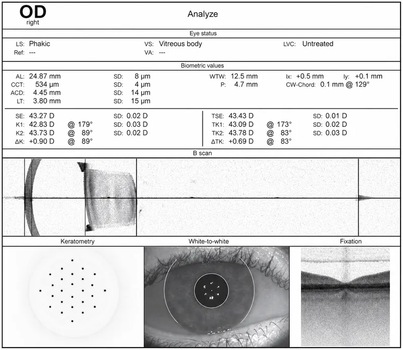 IOLMaster 700 Biometry Printout for IOL Power Calculation