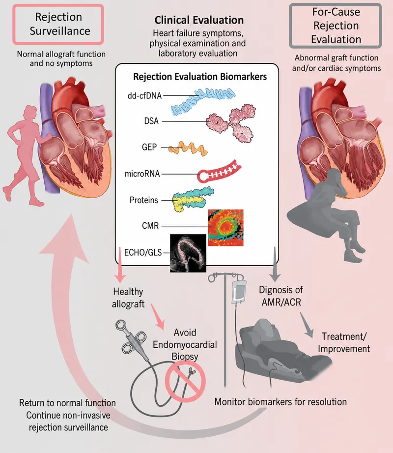 Heart Transplant Rejection Evaluation