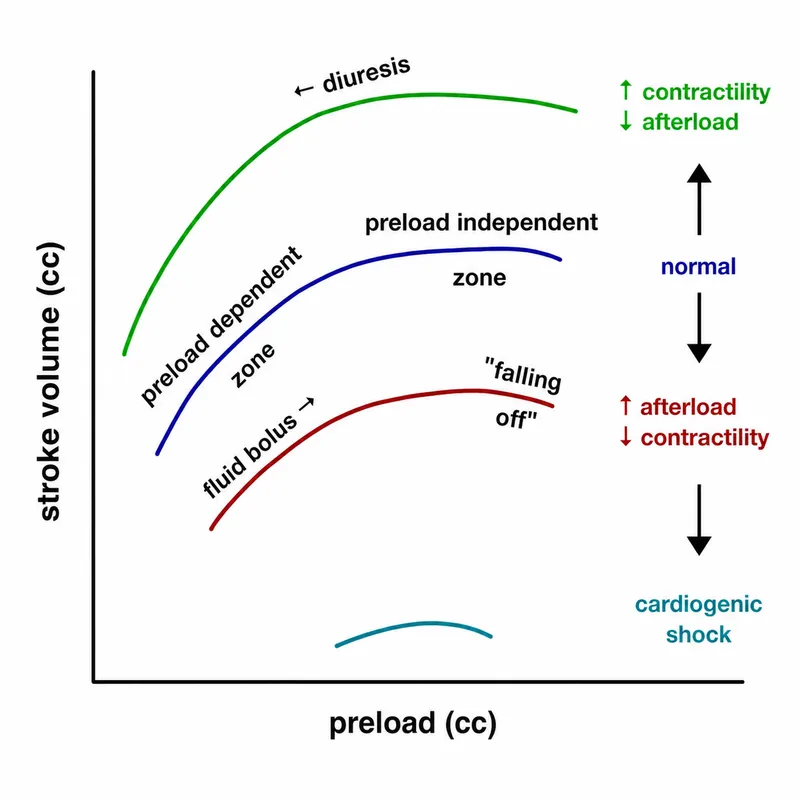 Frank-Starling curves: contractility, preload, afterload