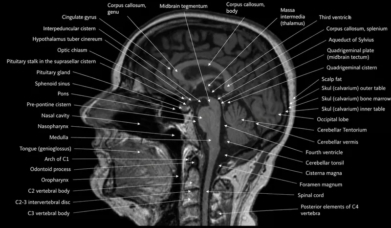 Detailed sagittal brain MRI showing major anatomical structures and divisions