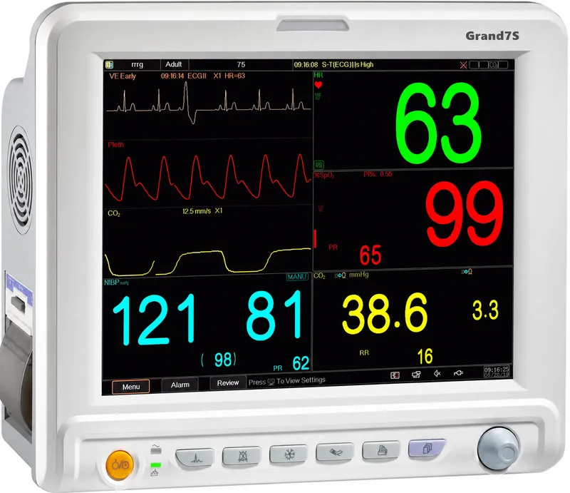 Anesthesia monitor display: ECG, SpO2, NIBP, ETCO2