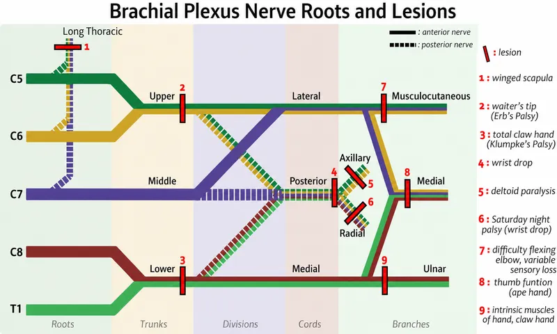 Brachial Plexus Nerve Roots and Lesions