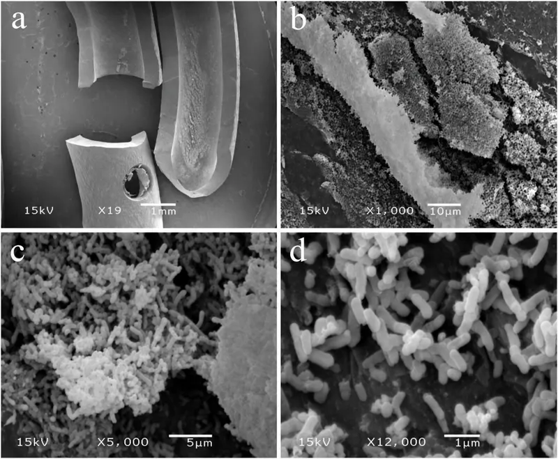SEM of bacterial biofilm on urinary catheter