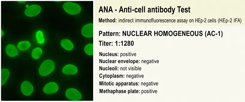 ANA Nuclear Homogeneous Pattern (AC-1) on HEp-2 cells