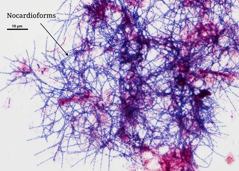 Nocardia gram stain showing branching filaments
