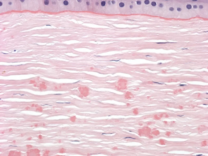 stromal collagen electron microscopy