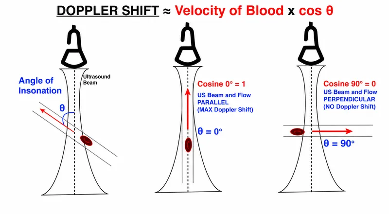Doppler shift and angle of insonation