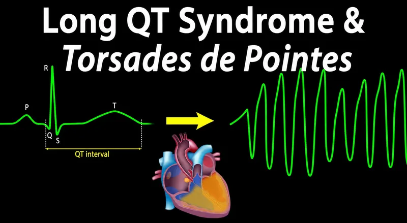 Long QT Syndrome and Torsades de Pointes ECG