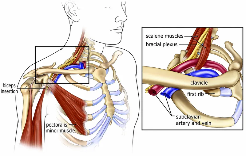 Thoracic Outlet Syndrome Compression Sites