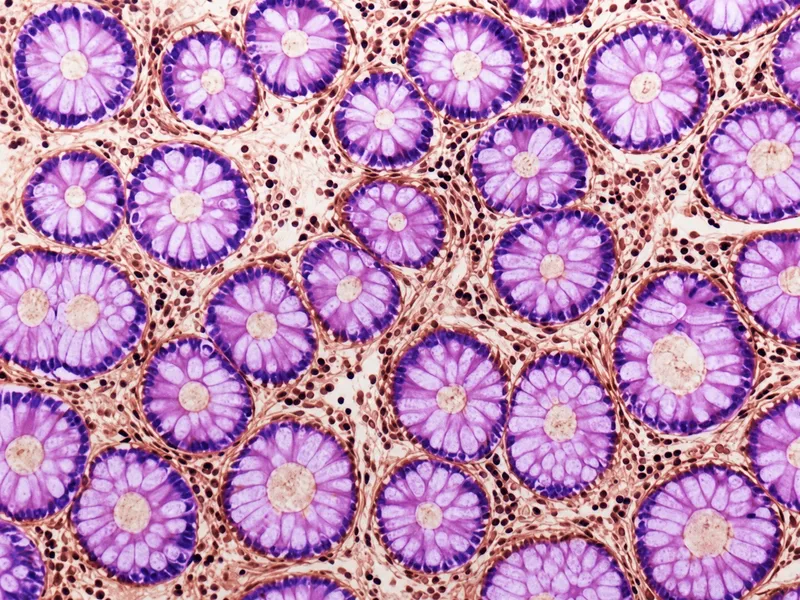 Colon histology: crypts of Lieberkühn and goblet cells