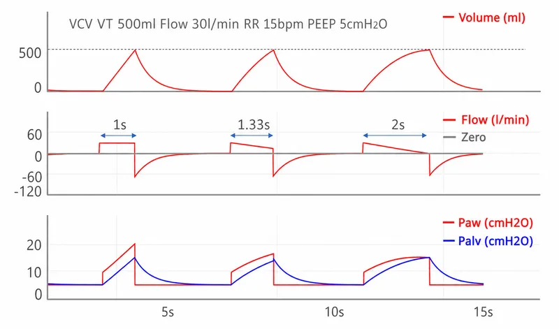 VCV mode waveforms with changing flow patterns