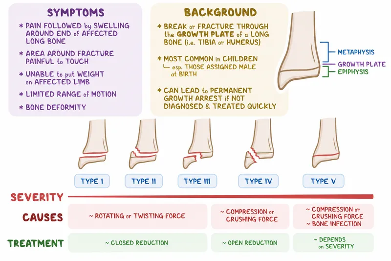 Salter-Harris Classification of Physeal Fractures
