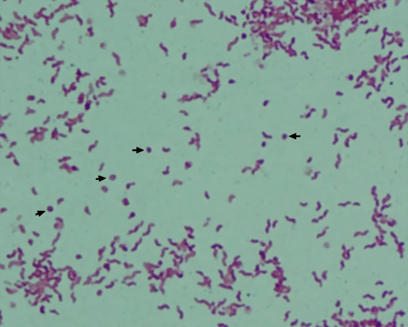 Campylobacter jejuni Gram Stain: Curved, S-shaped Rods