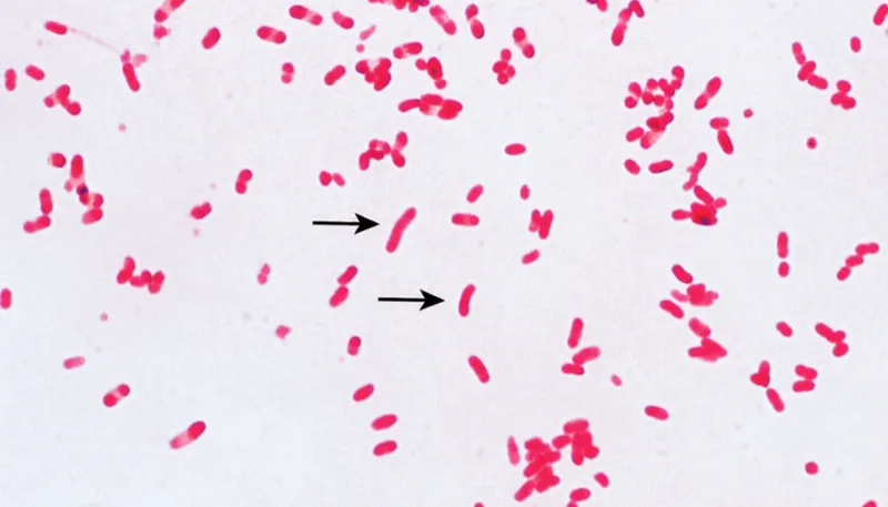 Gram stain of comma-shaped Gram-negative bacteria