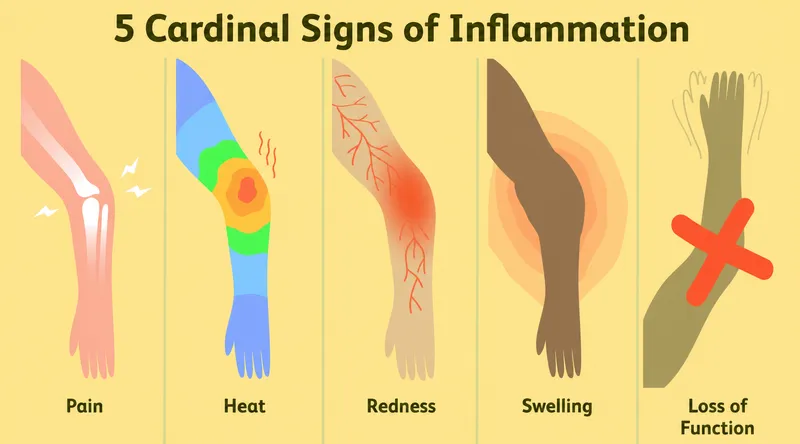 5 Cardinal Signs of Inflammation Diagram