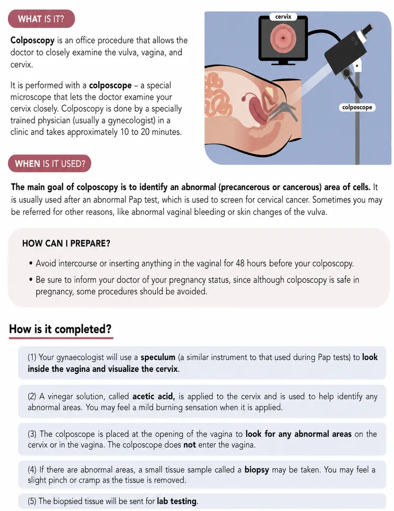 Colposcopy procedure diagram with explanation