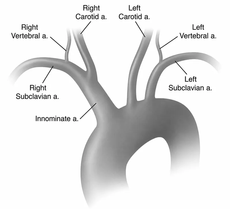 Aortic Arch Branches Diagram