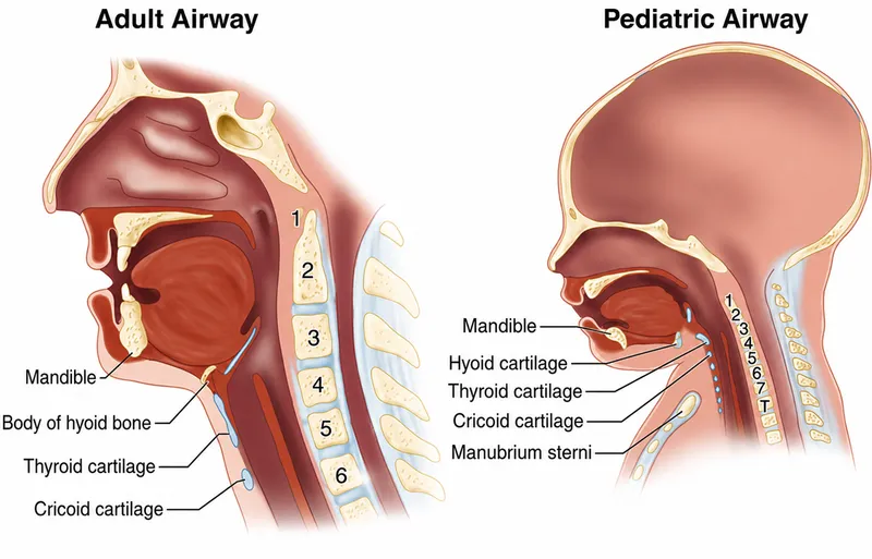 Adult vs. Pediatric Airway Anatomy
