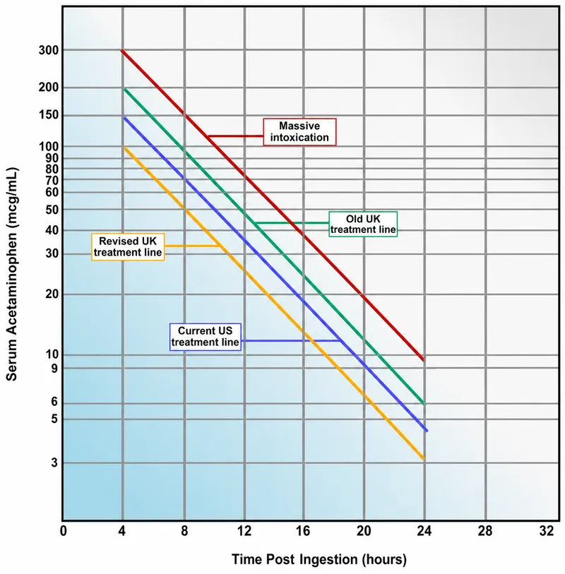Rumack-Matthew nomogram for paracetamol poisoning