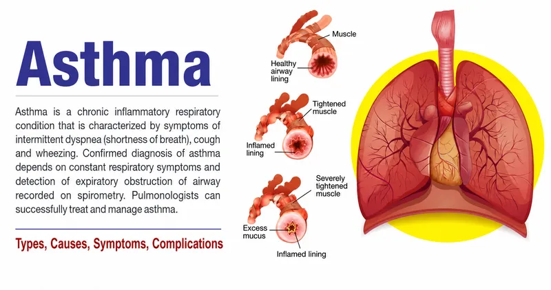 Asthma: Airway Changes and Lung Anatomy