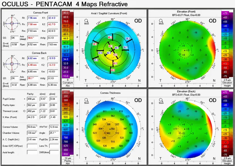 Comprehensive preoperative examination setup for refractive surgery candidacy