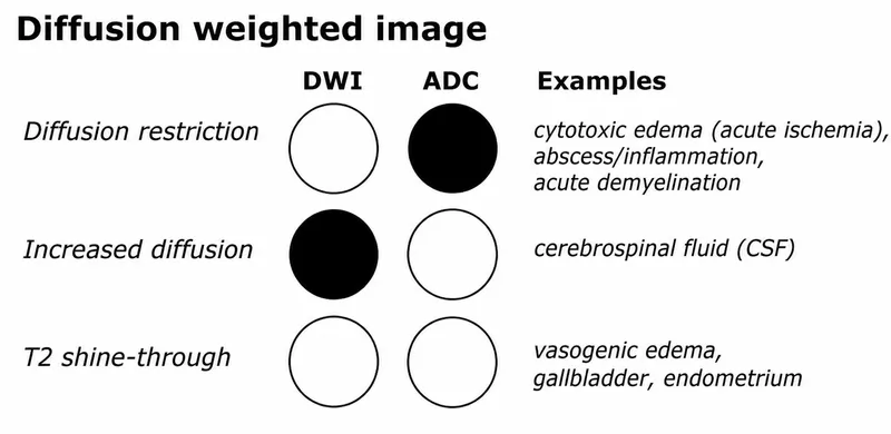 DWI and ADC signal characteristics and examples