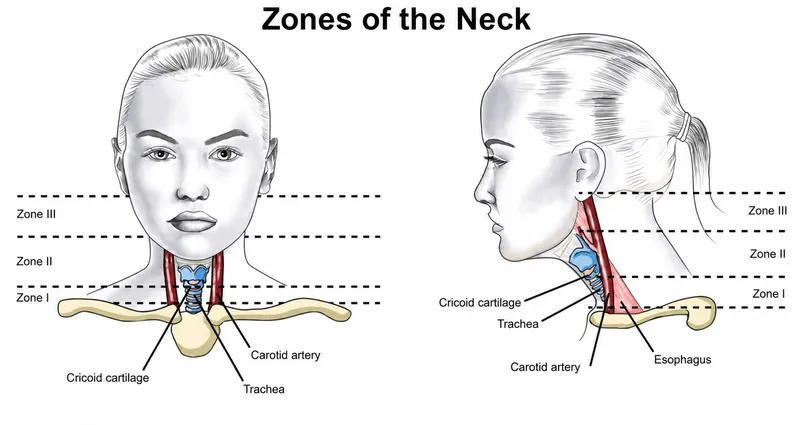 Zones of the Neck with Key Structures