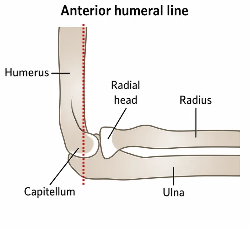 Anterior humeral line diagram
