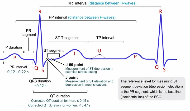 ECG Waveform Components and Intervals