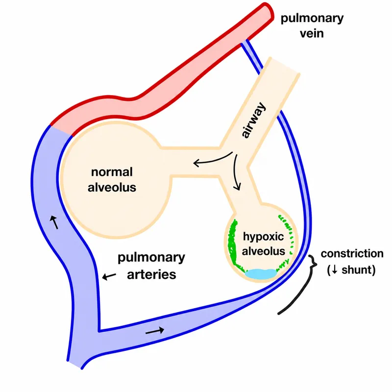 Hypoxic Pulmonary Vasoconstriction Diagram