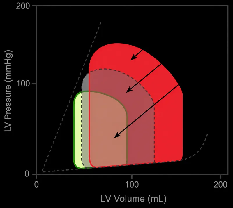 PV loops: increased afterload and diastolic dysfunction