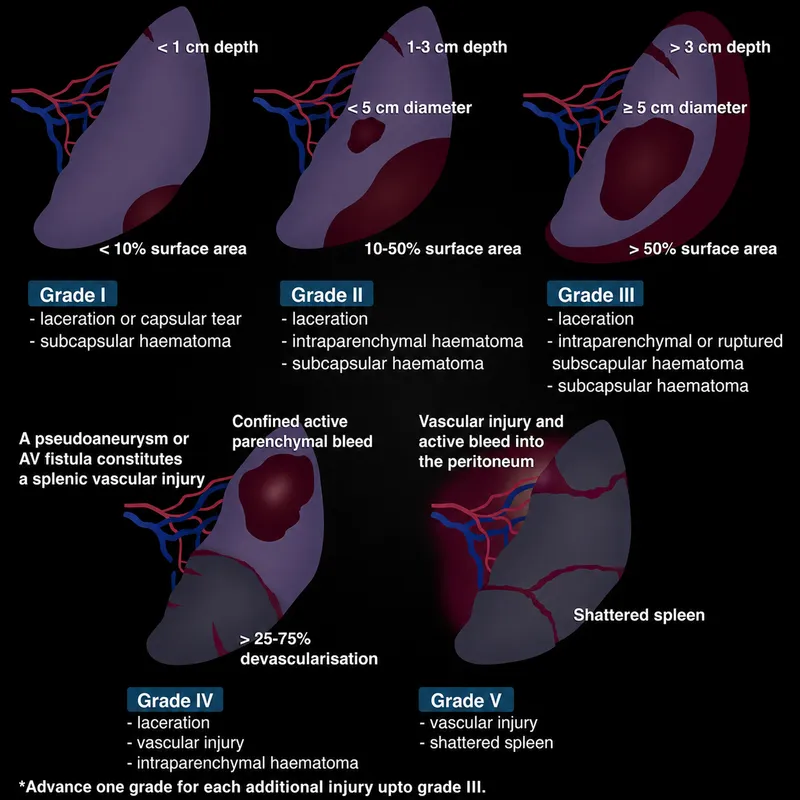 AAST Splenic Injury Grading