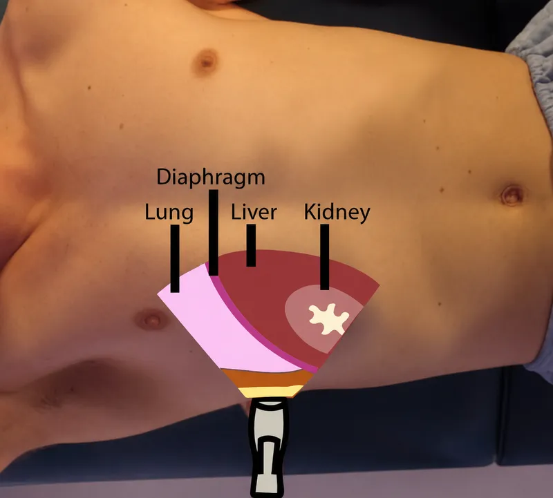 FAST Exam: Right Upper Quadrant View