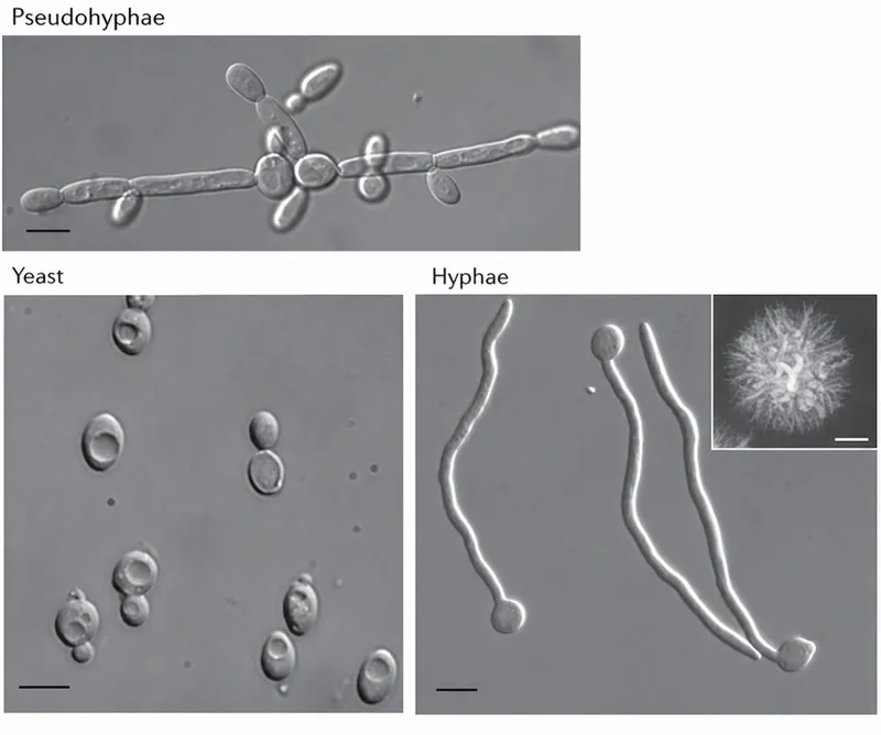 Candida: Yeast, Pseudohyphae, and Hyphae Microscopy