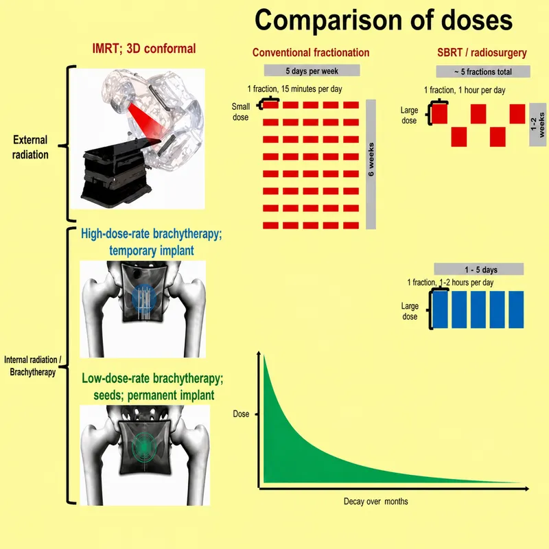 Radiation Therapy Doses and Techniques