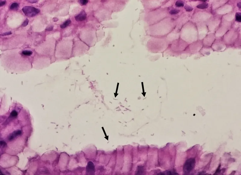 H. pylori in gastric pit, histopathology