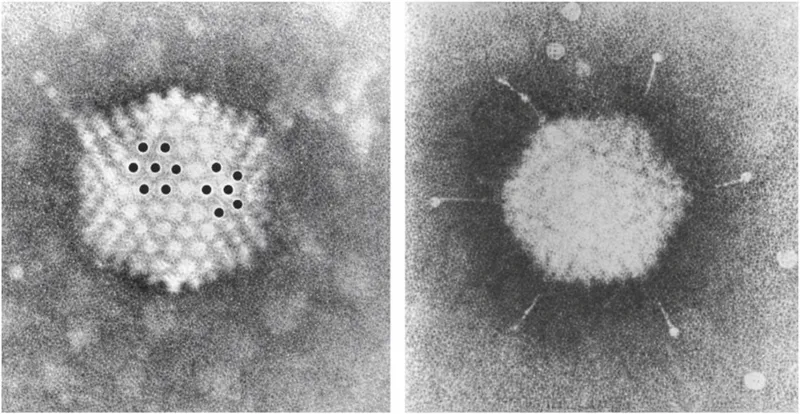 Adenovirus electron micrographs showing capsid structure