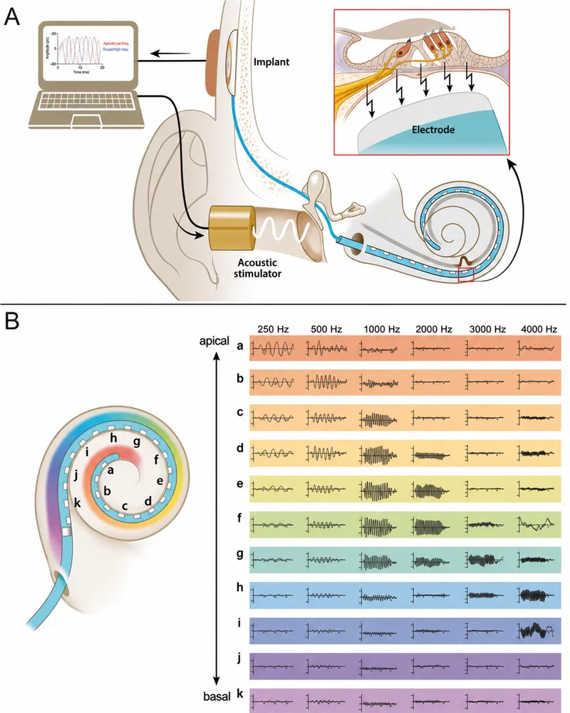 Cochlear implant placement and frequency mapping