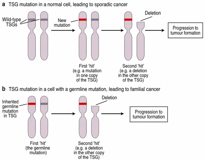 Knudson's two-hit hypothesis for TSG inactivation