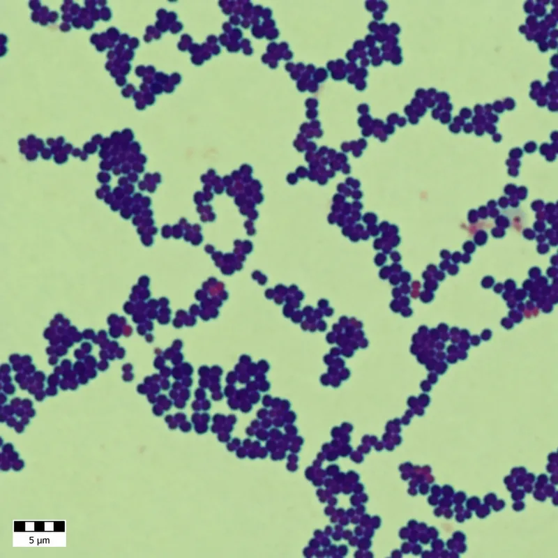 Staphylococcus aureus Gram stain: grape-like clusters