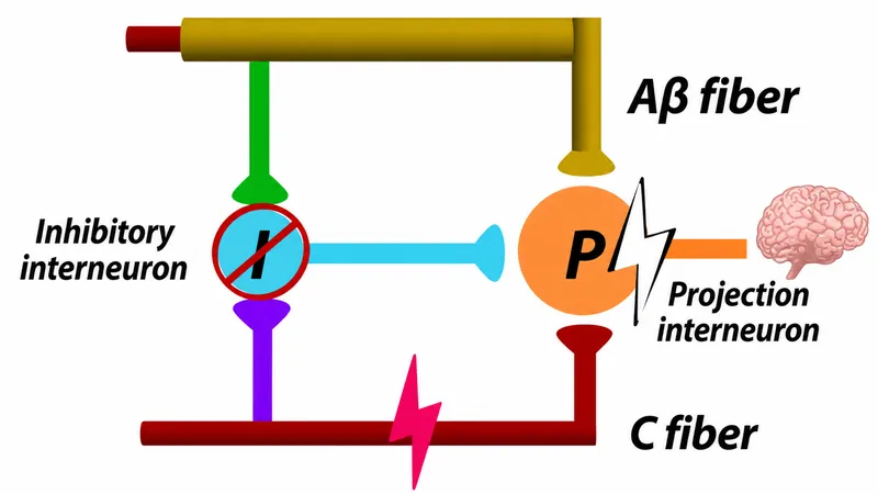 Gate Control Theory of Pain Diagram