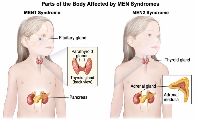 Organs affected by MEN1 and MEN2 syndromes