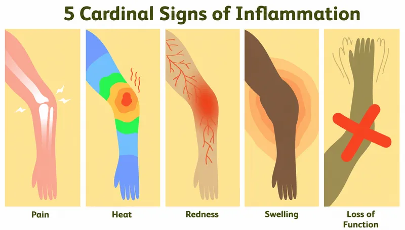 5 Cardinal Signs of Inflammation