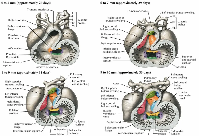 Heart outflow tract septation and development (27-33 days)